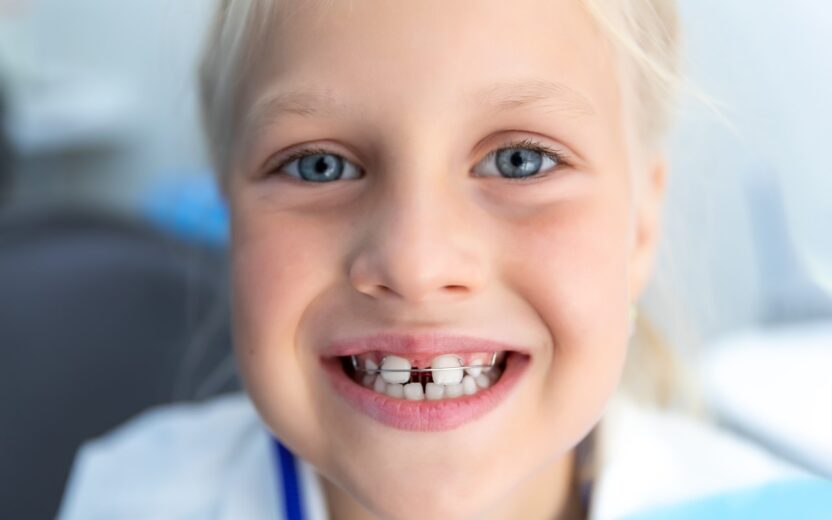 Uitneembare/ losse beugel